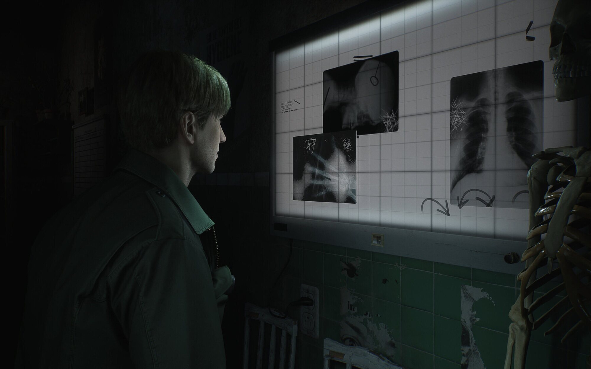 'Silent Hill 2 Remake', 'Townfall' y 'Ascension' se dejarán ver pronto, afirma un insider